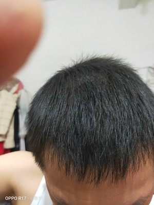 增发纤维的掩盖效果让人惊喜