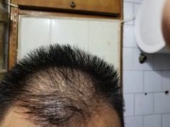 增发纤维使用后的效果太让人惊喜了