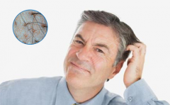 洗发太勤和脱发之间有关系吗