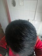 增发纤维解决了我好多的烦恼