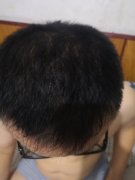 增发纤维帮我脱离了黑暗