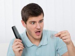 导致年轻男性脱发的原因是什么