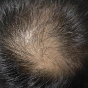 遇到增发纤维我心里真的好高兴