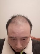 增发纤维果然没有让我失望