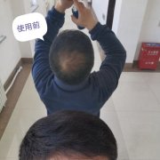 增发纤维的应急效果特别棒