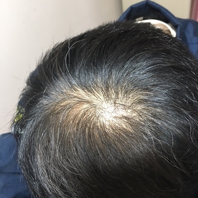 遇到增发纤维之后我真的好后悔