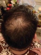 增发纤维太神奇了