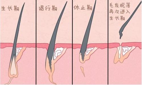 什么时候植发最合适