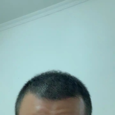 增发纤维恢复了我的头发