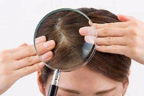 什么方法能够预防女性脱发