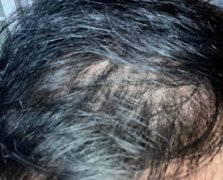 幸好我遇见了增发纤维