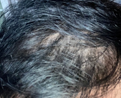 幸好我遇见了增发纤维