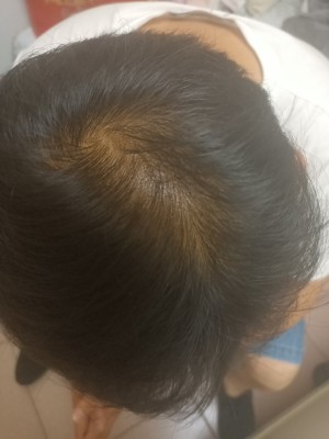 增发纤维给了我一个好的结果