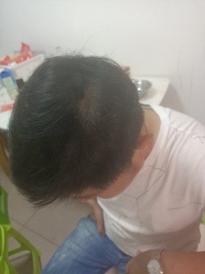 增发纤维给了我一个好的结果