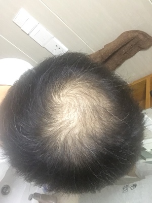 增发纤维真的好划算