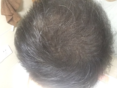 增发纤维真的好划算