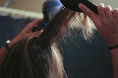 女性脱发是什么原因导致的