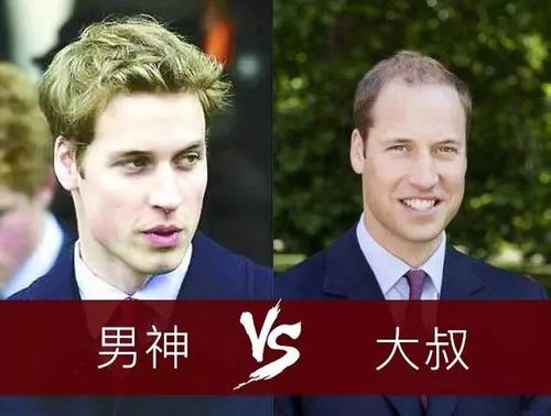 脱发并发症——让生活屡屡受挫!
