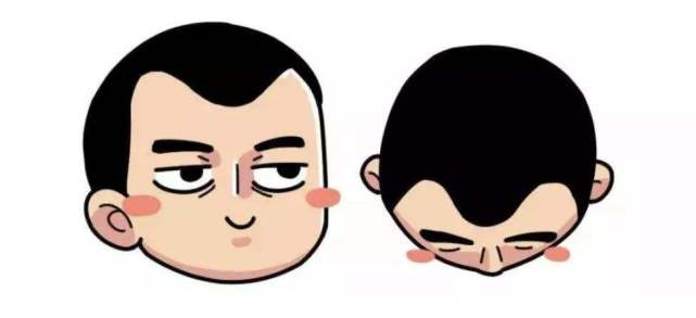 令人烦恼的M型脱发如何改善?