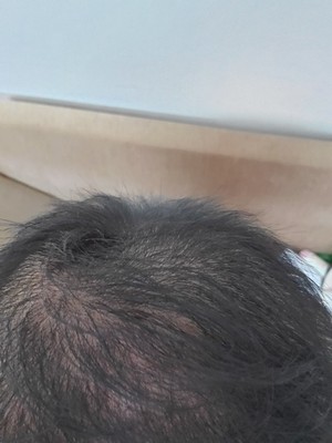 增发纤维正是我想要的