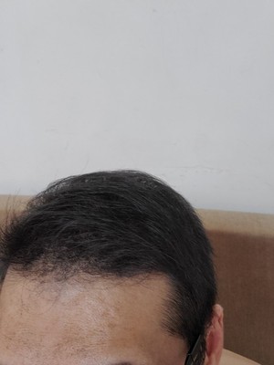 增发纤维正是我想要的