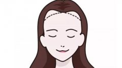 哪些方法可以调整发际线