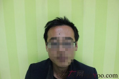 来杭州新生改变，植发2500单位让笑容更自信