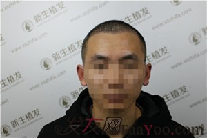 额角后退留长发欲盖弥彰？有广州新生在不用怕这些