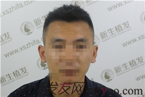 额角后退留长发欲盖弥彰？有广州新生在不用怕这些