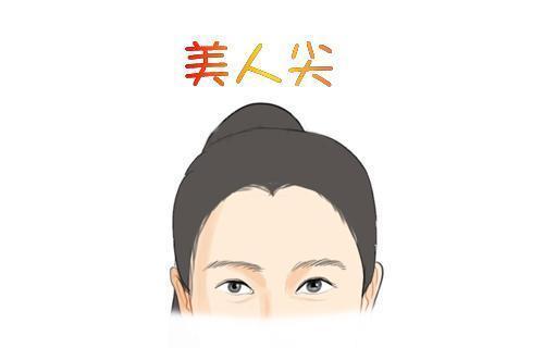 美人尖可以种植吗