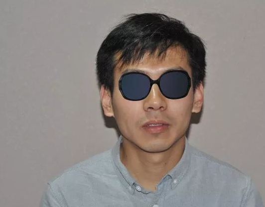 福建福州90后小伙记录植发全过程，看看大额头从大到小