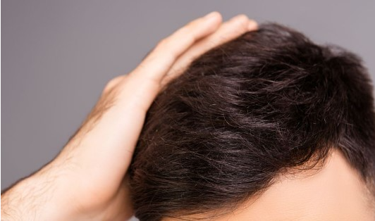 发际线植发有危险吗