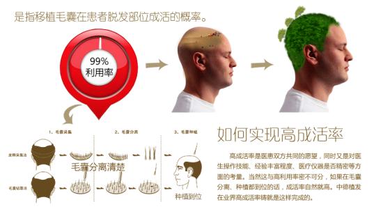 北京植发效果好的医院有哪些,费用是多少?