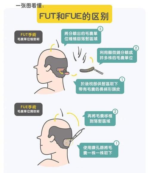 济南哪家医院可以放心植发,避免被坑?