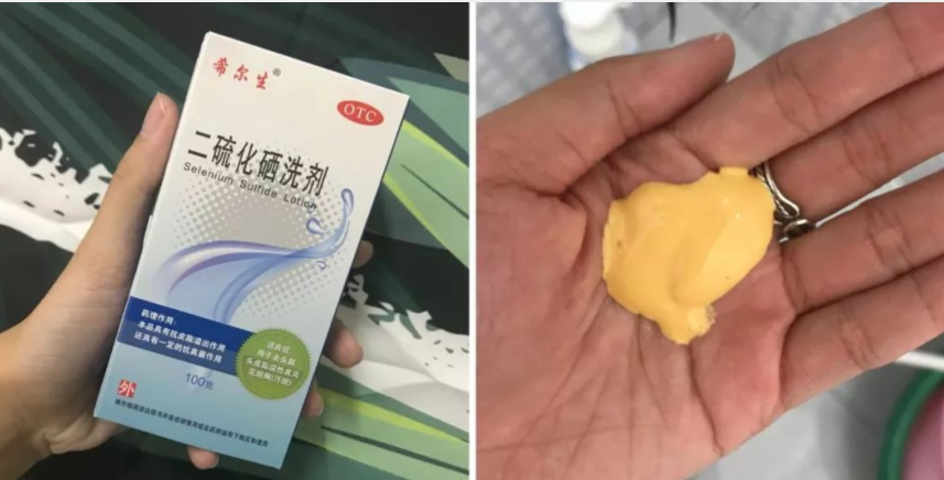 二硫化硒洗剂好用吗，使用二硫化硒的亲身经验分享