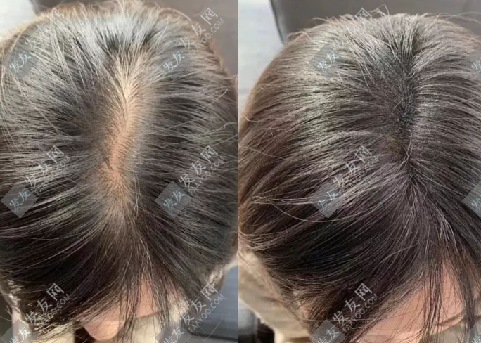 蘇玫氏頭發纖維粉使用方法